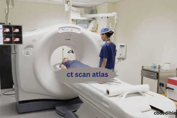 ct scan atlas