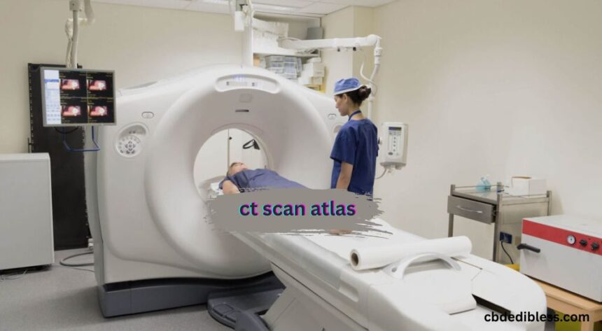 ct scan atlas