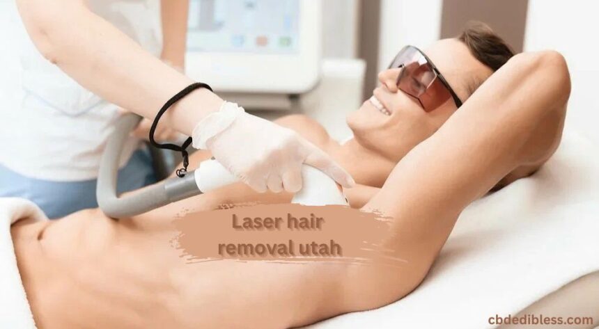 laser hair removal utah